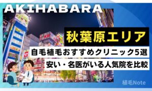秋葉原駅の自毛植毛おすすめクリニック！安い・名医がいるのはどこ？