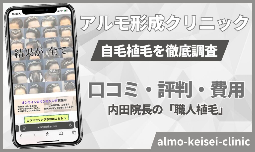 アルモ形成クリニック自毛植毛の口コミやばいの？内田院長の評判も！