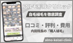 アルモ形成クリニック自毛植毛の口コミやばいの？内田院長の評判も！