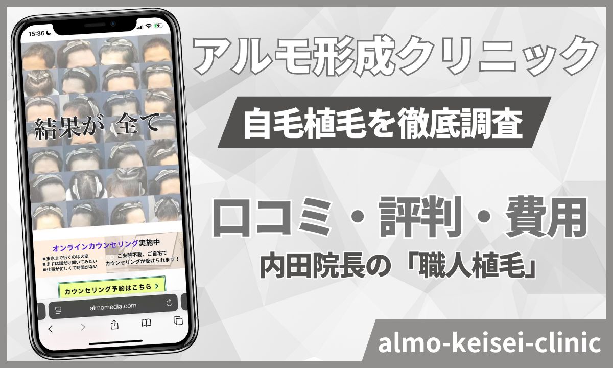 アルモ形成クリニック自毛植毛の口コミやばいの？内田院長の評判も！