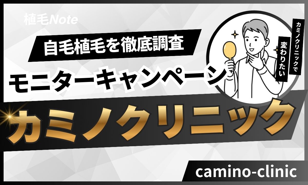 カミノクリニック自毛植毛のモニター・キャンペーン一覧！
