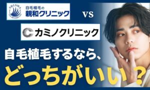 親和クリニックとカミノクリニックを徹底比較!どっちの自毛植毛を選ぶべき?