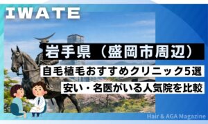 【岩手・盛岡】自毛植毛おすすめクリニック5選！交通費補助の裏ワザ